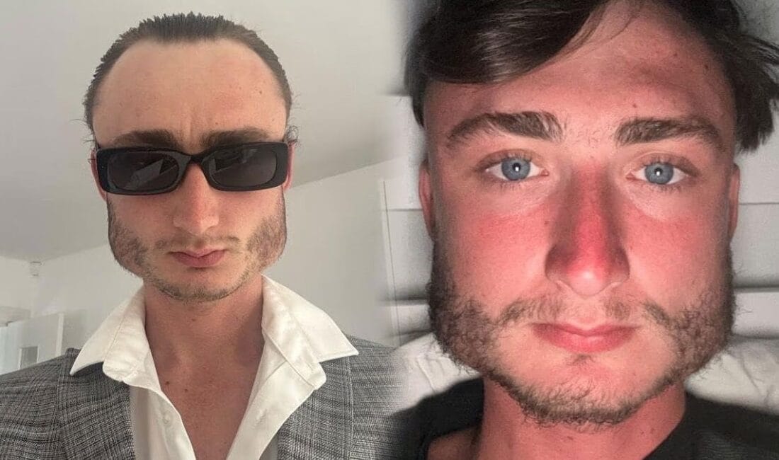 İngiltere'de yaşayan 23 yaşındaki Linx, yıllarca çıplak elle dövüş yaptığı